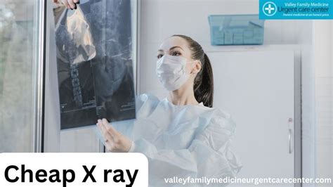 bay area cheap xray